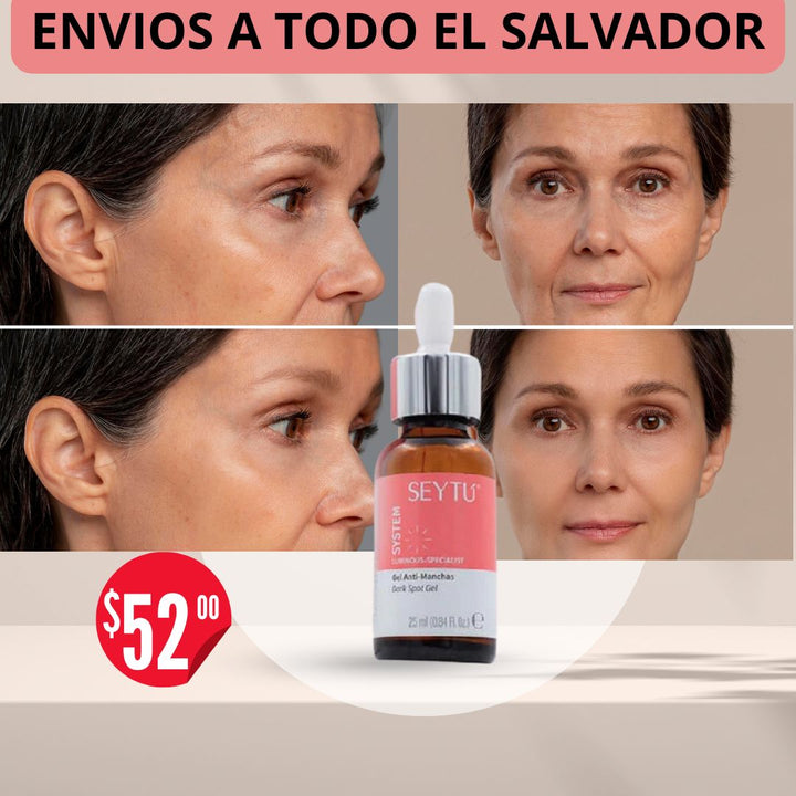 GEL ACLARADOR PARA MANCHAS EN EL ROSTRO