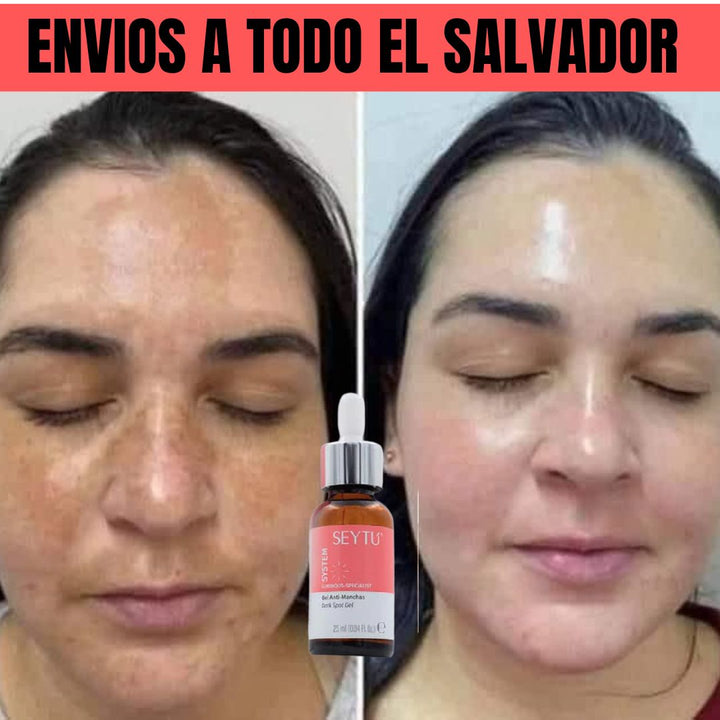 GEL ACLARADOR PARA MANCHAS EN EL ROSTRO