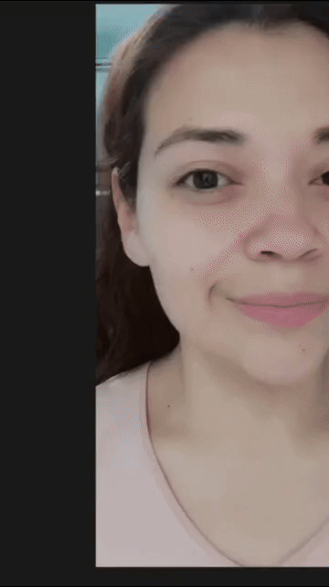 KIT ANTI ACNÉ 😍